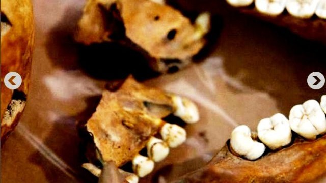 Huesos revelan enfermedades y tipo de vida prehispánicos