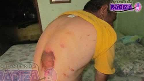 Discapacitado golpeado por policías de Rosales