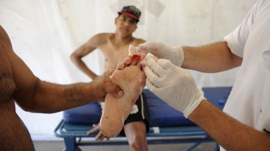 Unos 60 heridos en Argentina por un ataque de pirañas
