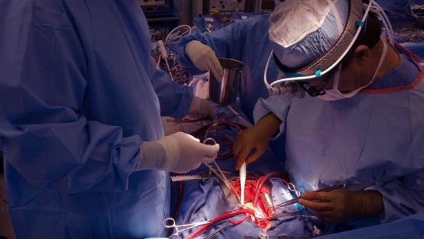 Médicos sudafricanos realizan con éxito el primer trasplante de pene