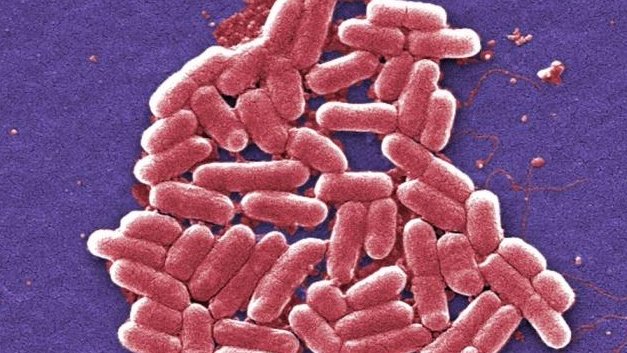 Reporta EU primer caso de bacteria resistente a antibióticos