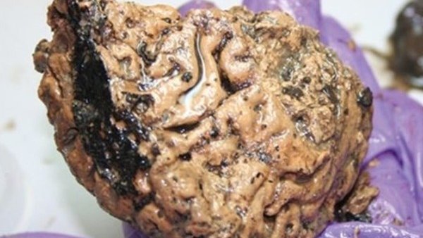 Descubren un cerebro humano de 2 mil 600 años