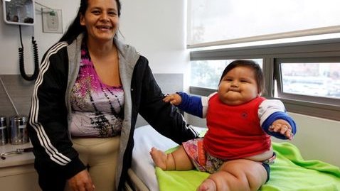 Bebé de ocho meses pesa 20 kilos; podría sufrir paro