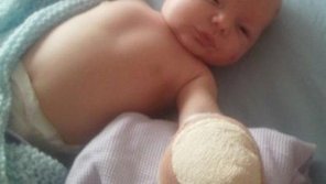 Bebé de un mes fue atacado por un zorro urbano en su casa en Londres