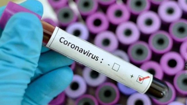 Confirman segundo caso de coronavirus en Chihuahua