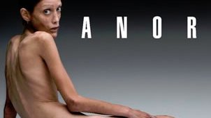 Muere Isabelle Caro imagen de la lucha contra la anorexia 