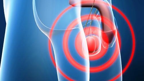 Llaman a no subestimar dolor en testículos: puede ser grave