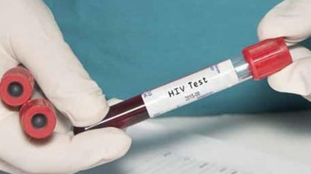 Científicos estudian ganglios linfáticos para vacuna contra VIH