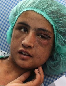 Torturada una joven afgana por la familia de su marido por negarse a prostituirse 
