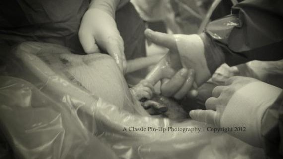 Bebé que en cesárea toma mano de cirujano, primer viral del año 