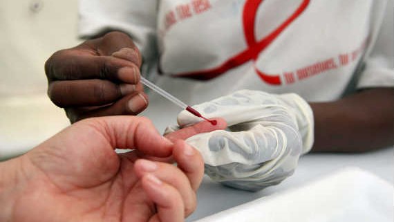 Científicos desarrollan gelatina vaginal que promete proteger contra el contagio de VIH